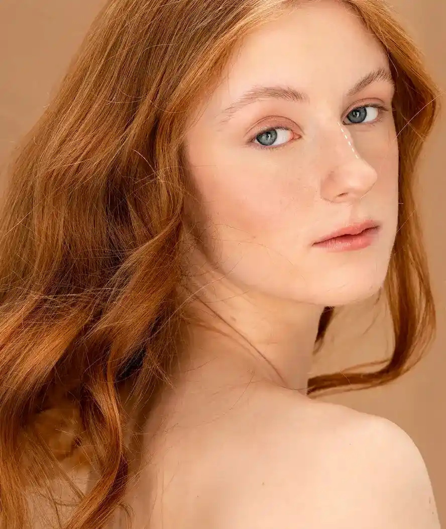 Before Rhinoplasty
