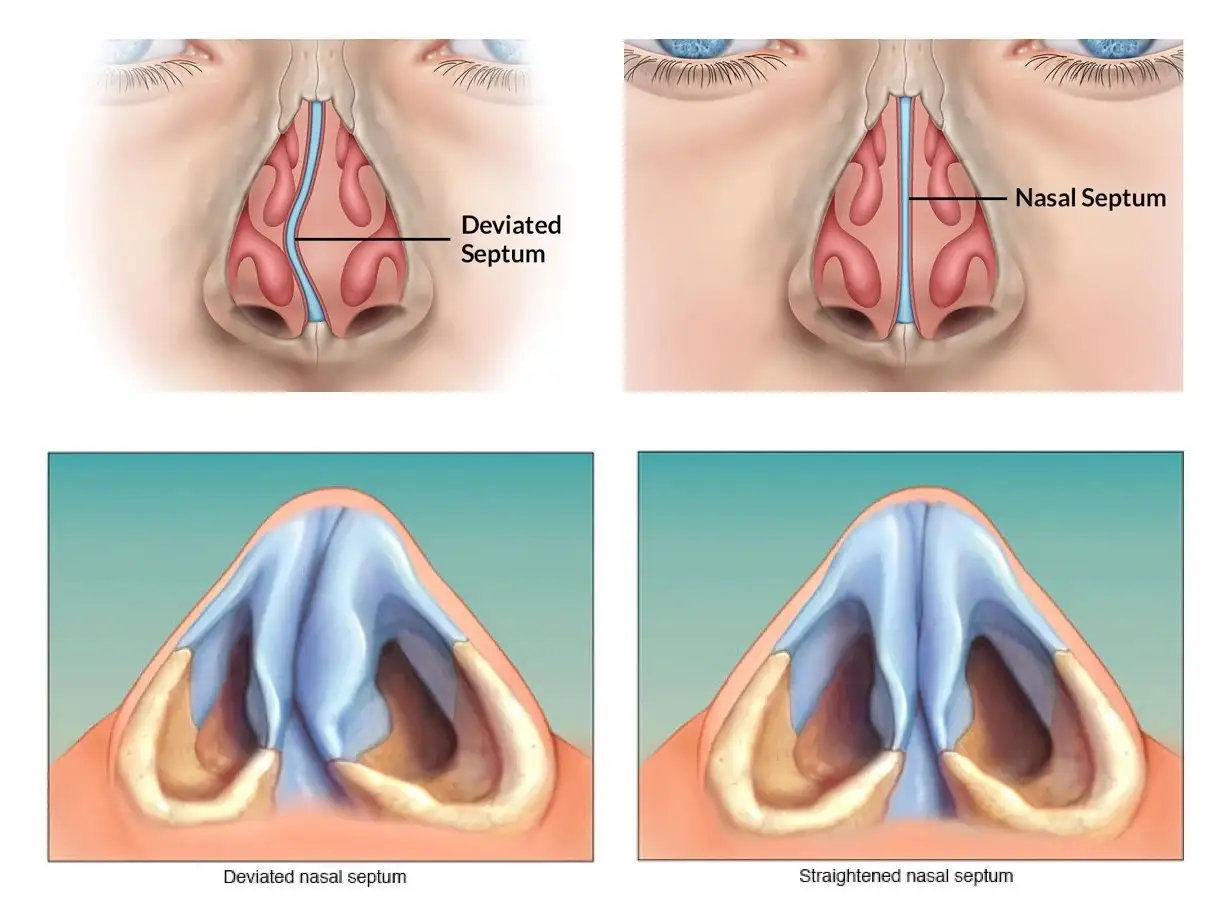 Skilled ENT Surgeon Performing Surgery