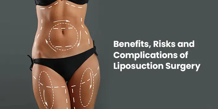 Liposuction Body Contour Results