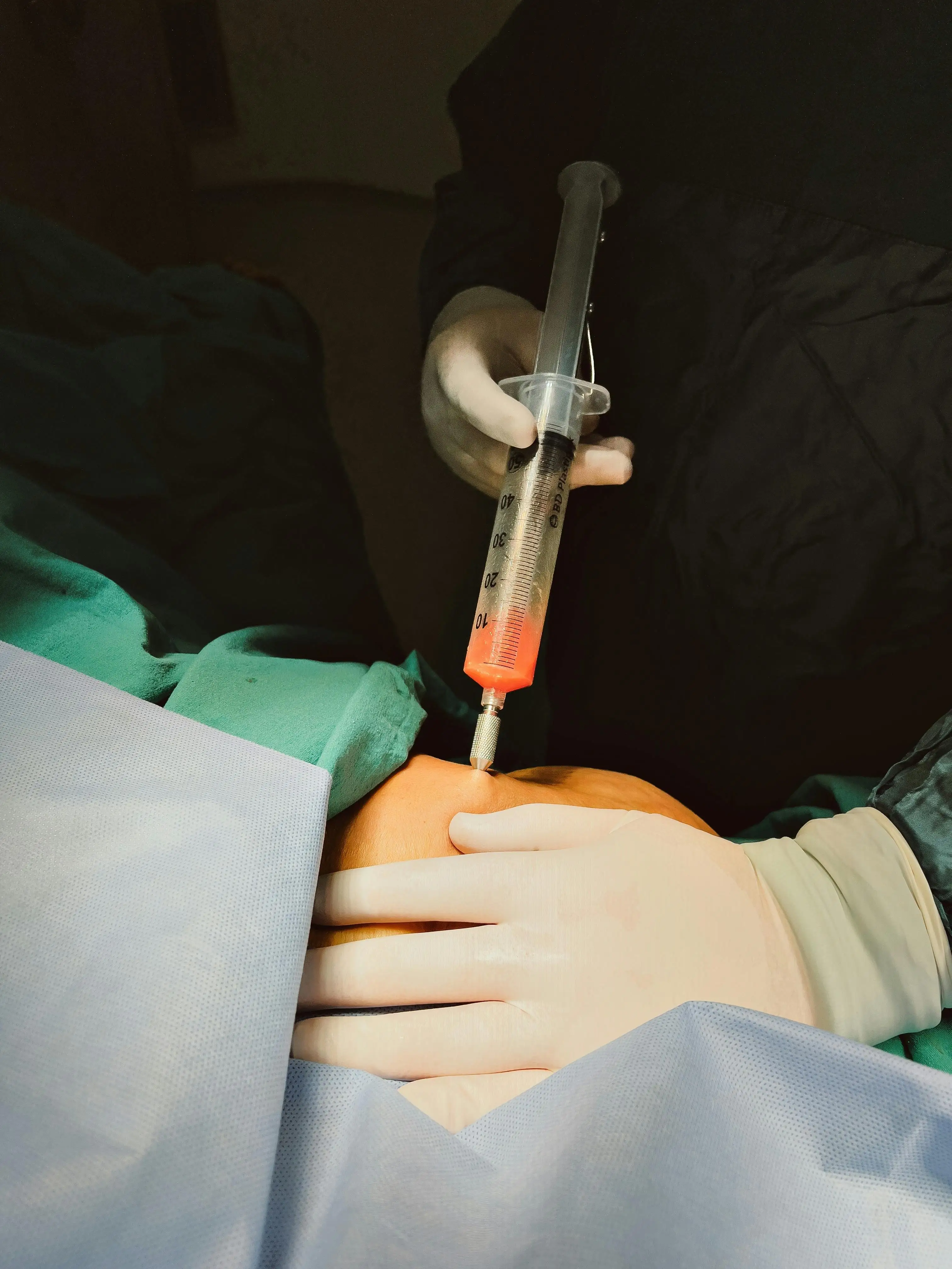 Liposuction Operating Room